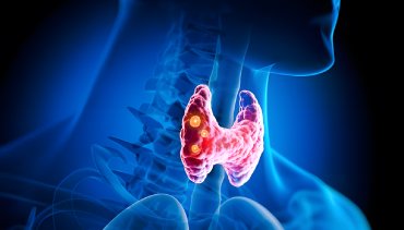 Illustration of a thyroid gland glowing in vibrant colors, representing thyroid health and treatment, relevant to holistic wellness and chiropractic care in Bellingham, WA.